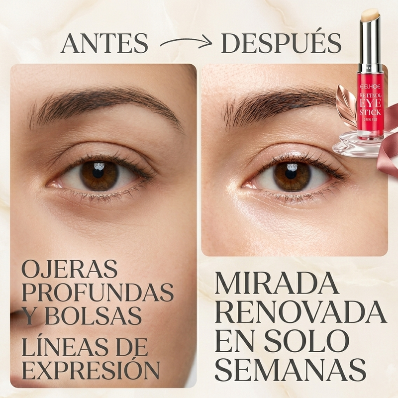 Retinol Borrador de Ojeras!!